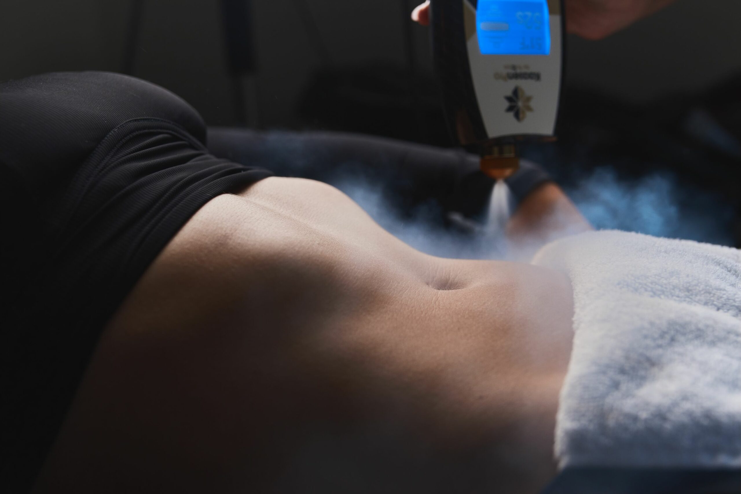 A woman receiving cryo slimming treatment on her stomach
